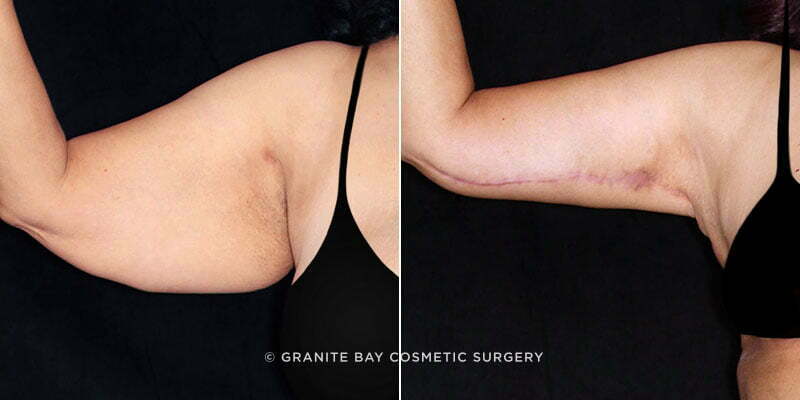 Case # 12 after photo