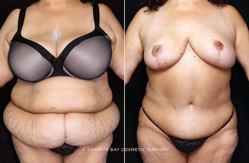 Case # 51 after photo