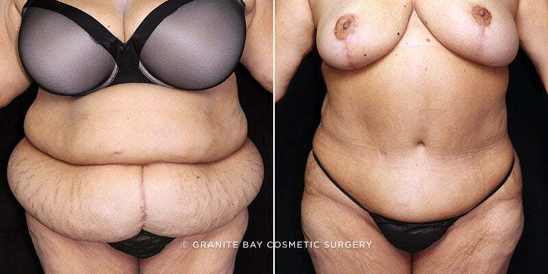 Case # 88 after photo