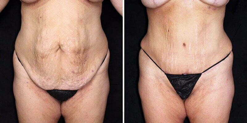 Case # 89 after photo