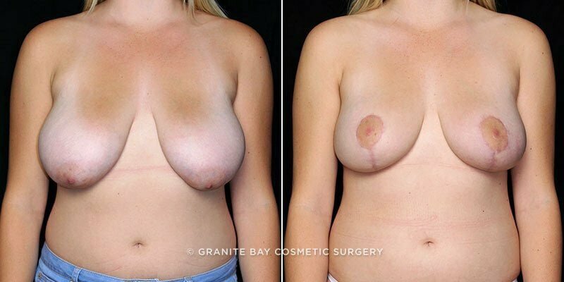 Case # 36 after photo