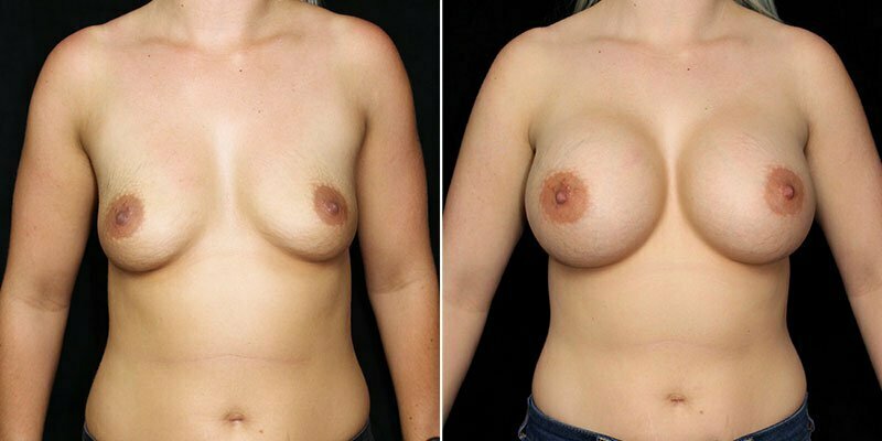 Case # 96 after photo