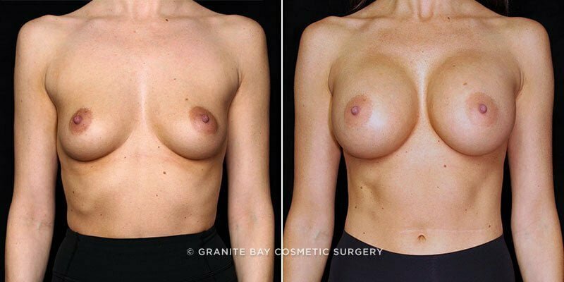 Case # 98 after photo