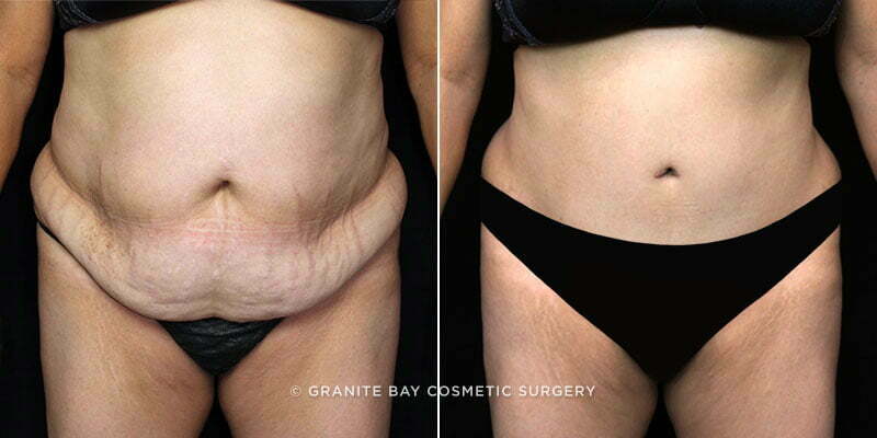 Case # 96 after photo