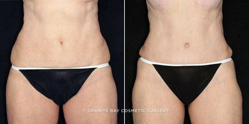 Case # 99 after photo