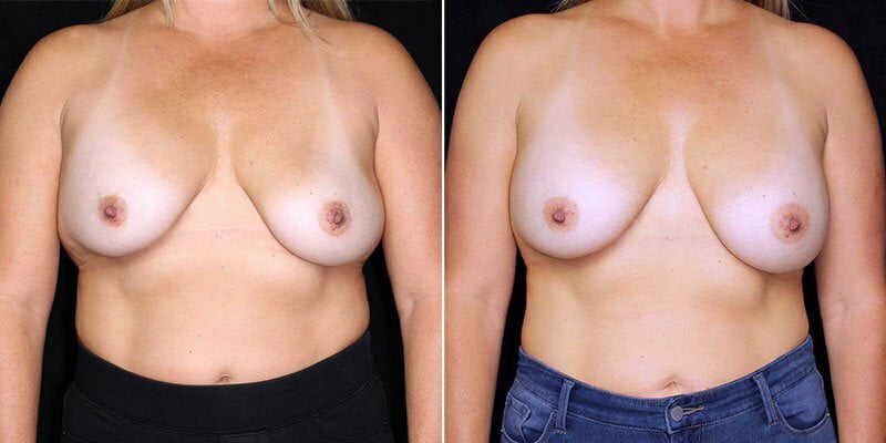 Case # 66 after photo