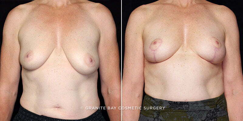 Case # 22 after photo