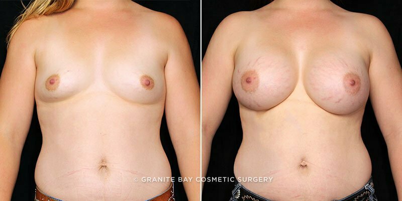 Case # 101 after photo