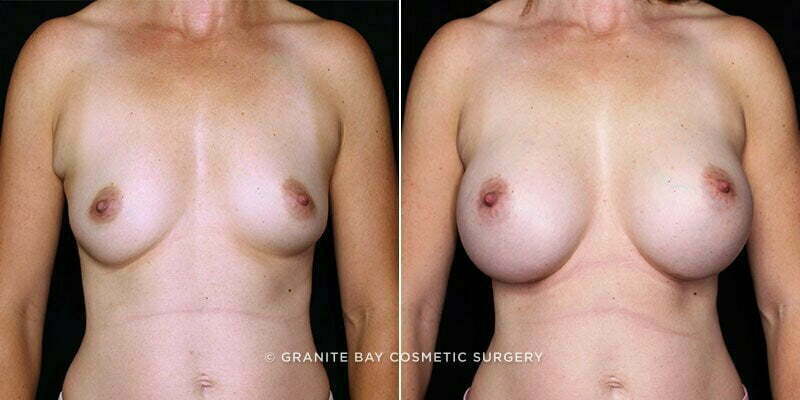 Case # 103 after photo