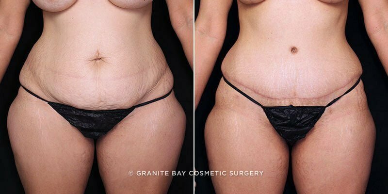 Case # 102 after photo