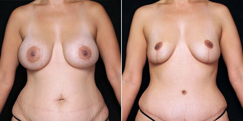 Case # 41 after photo