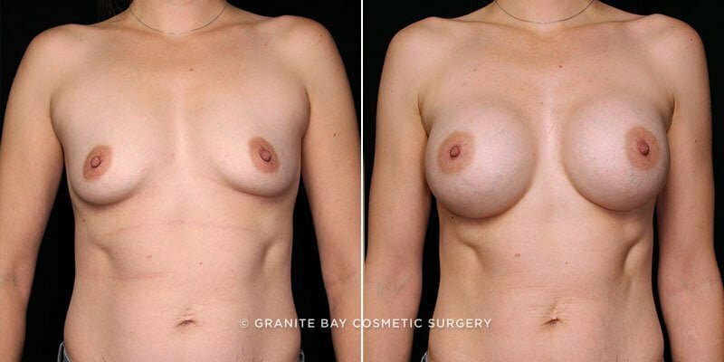 Case # 106 after photo