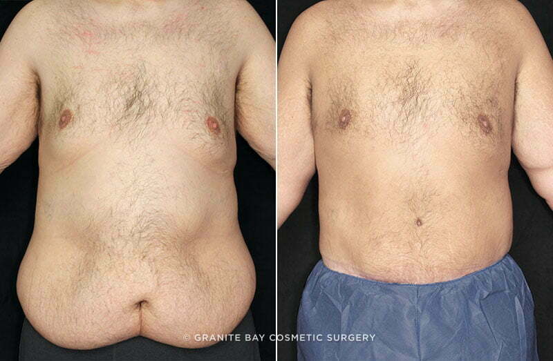 Case # 12 after photo