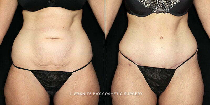 Case # 108 after photo