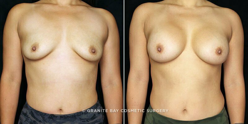 Case # 107 after photo