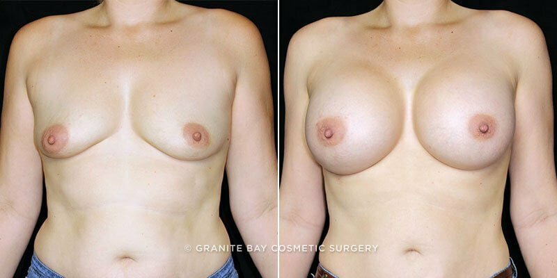 Case # 108 after photo