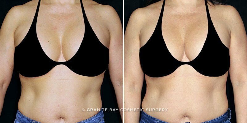 Case # 1 after photo