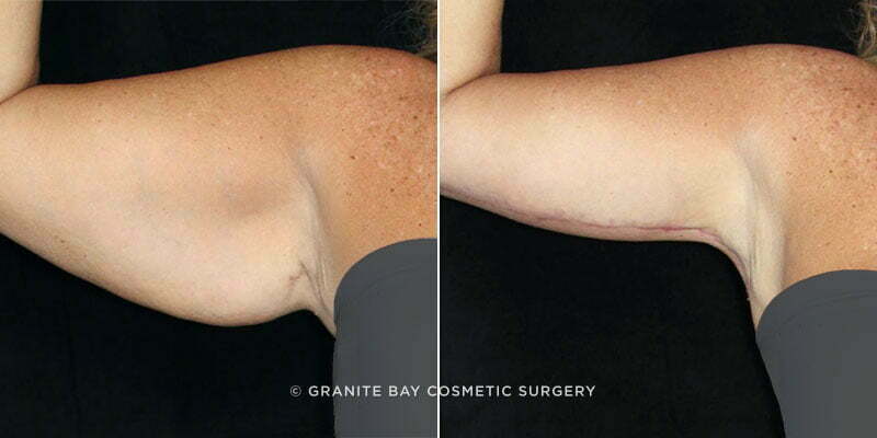 Case # 15 after photo