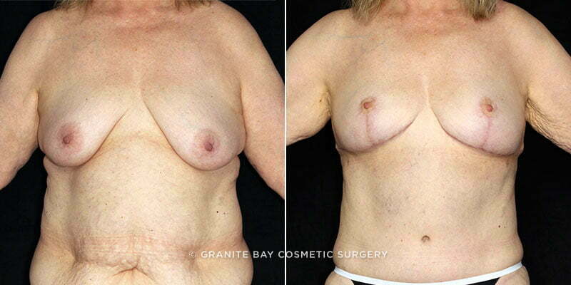 Case # 24 after photo