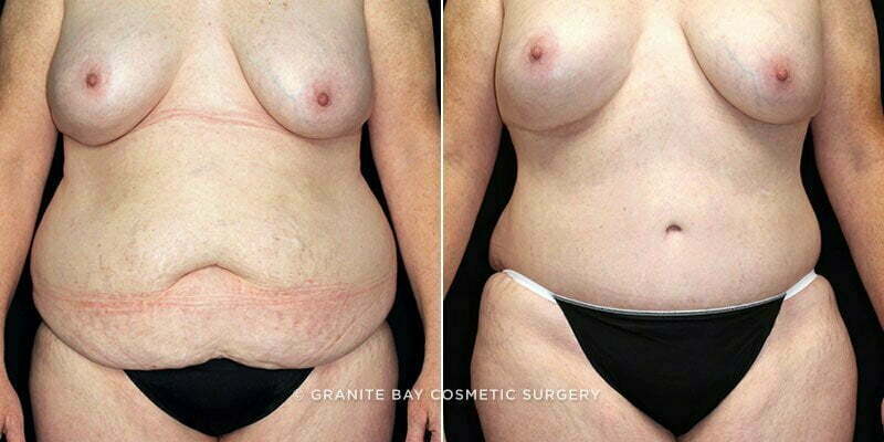 Case # 114 after photo