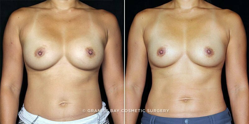 Case # 76 after photo