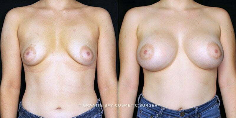 Case # 111 after photo