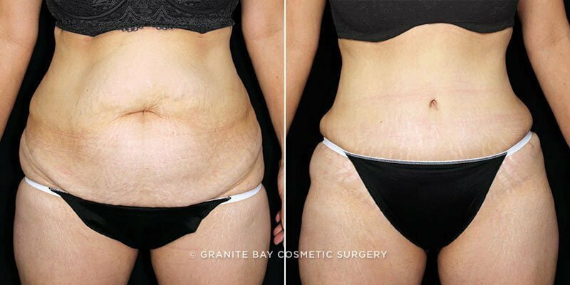 Case # 117 after photo