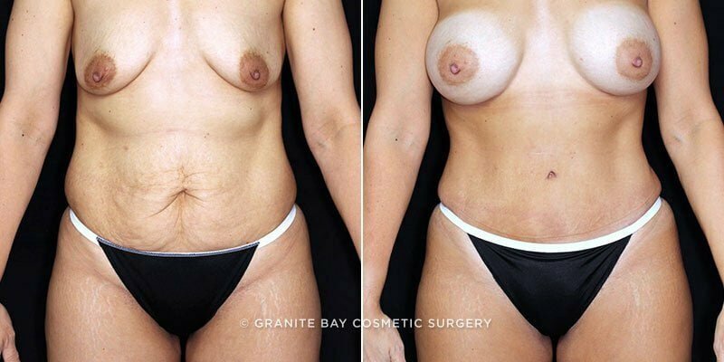 Case # 118 after photo