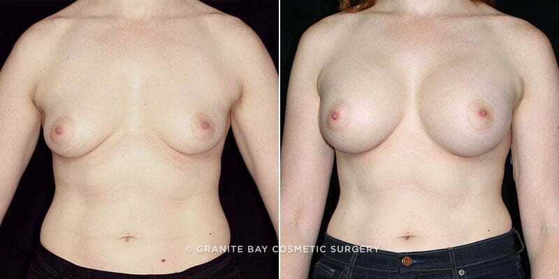 Case # 113 after photo