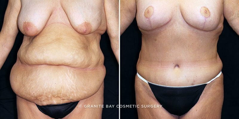 Case # 119 after photo