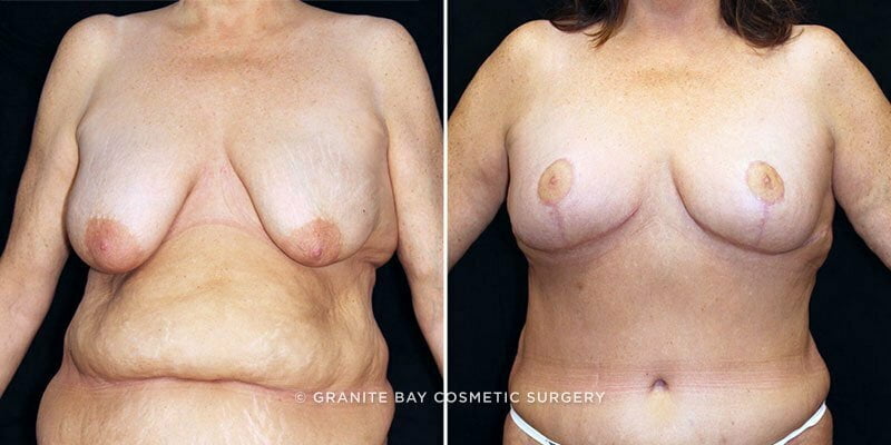 Case # 25 after photo