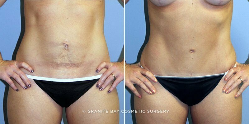 Case # 120 after photo