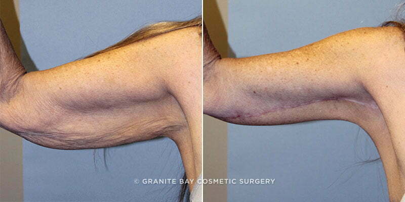 Case # 16 after photo