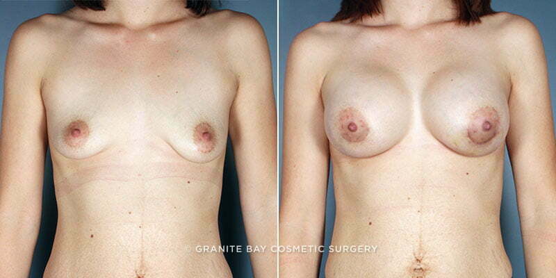 Case # 119 after photo