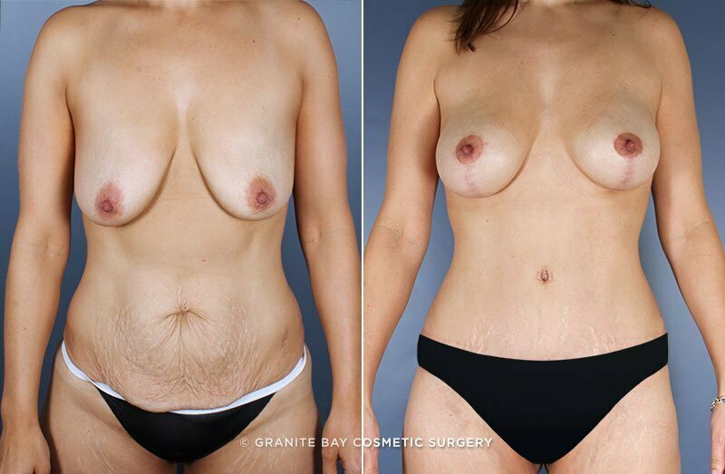 Case # 63 after photo