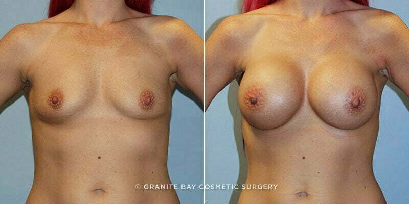 Case # 121 after photo