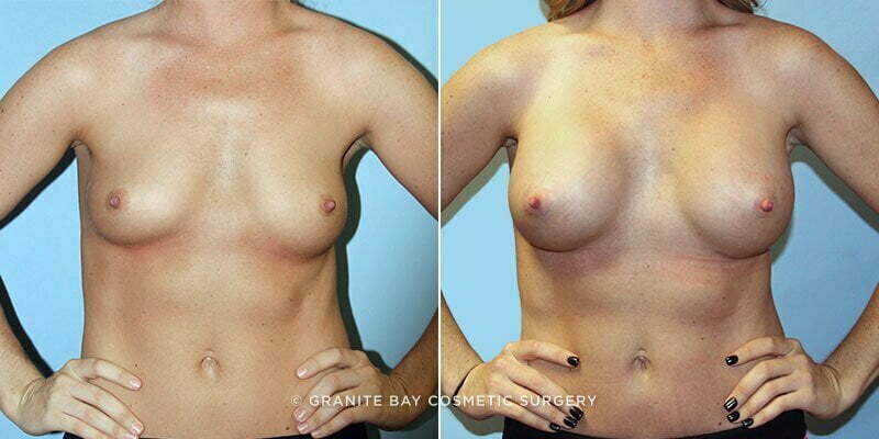 Case # 122 after photo