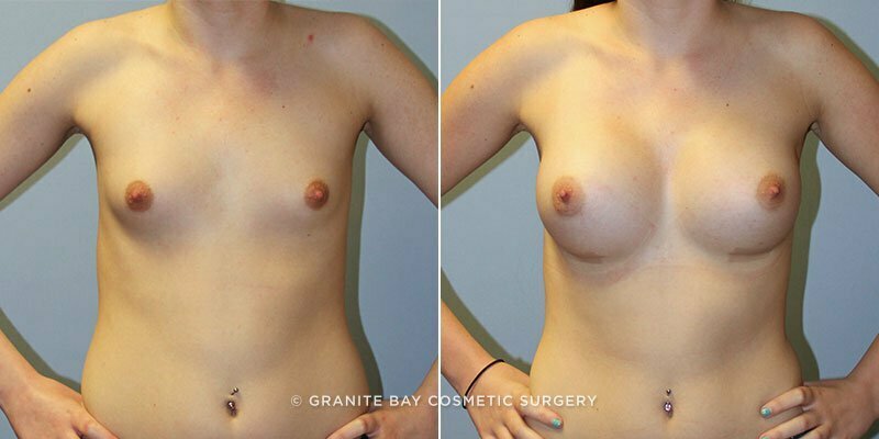 Case # 125 after photo