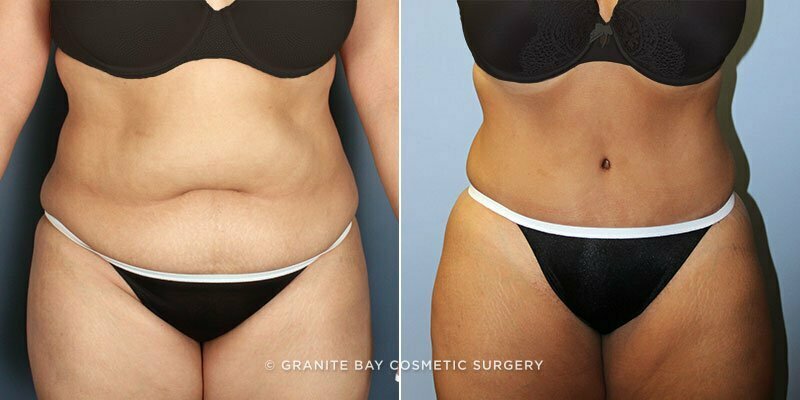 Case # 124 after photo