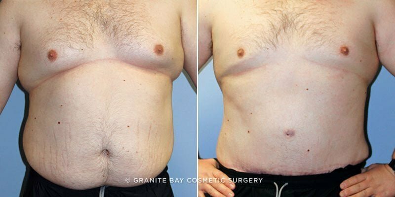 Case # 125 after photo