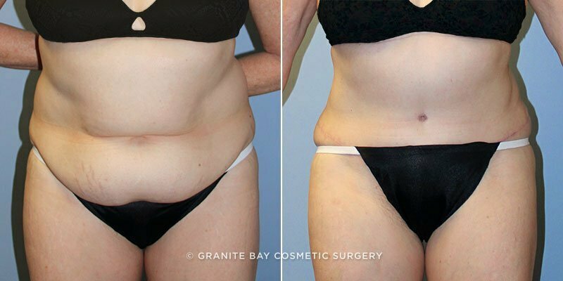 Case # 126 after photo