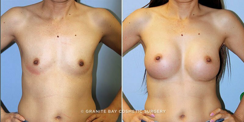 Case # 126 after photo