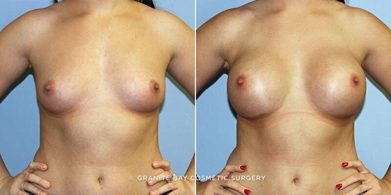 Case # 130 after photo