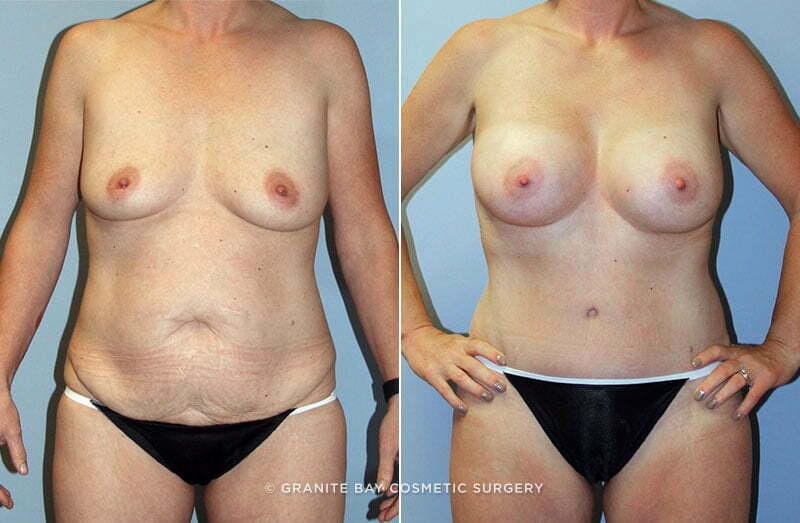 Case # 65 after photo