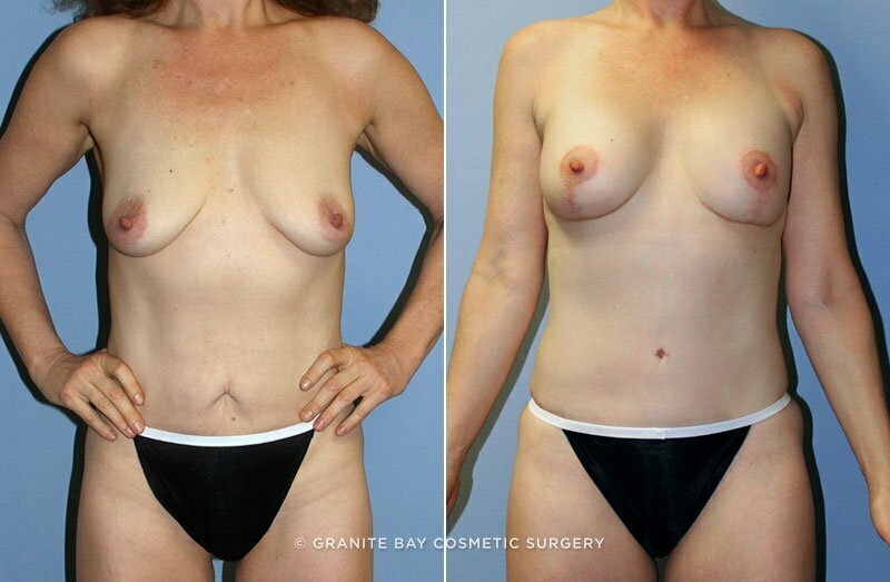 Case # 66 after photo