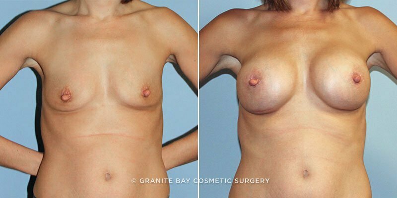 Case # 131 after photo