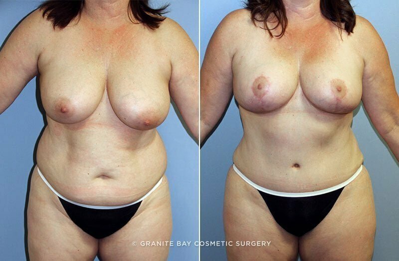 Case # 67 after photo