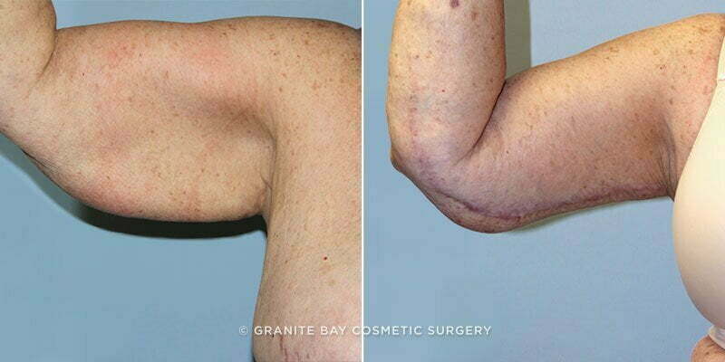 Case # 18 after photo