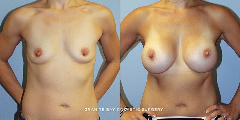 Case # 133 after photo