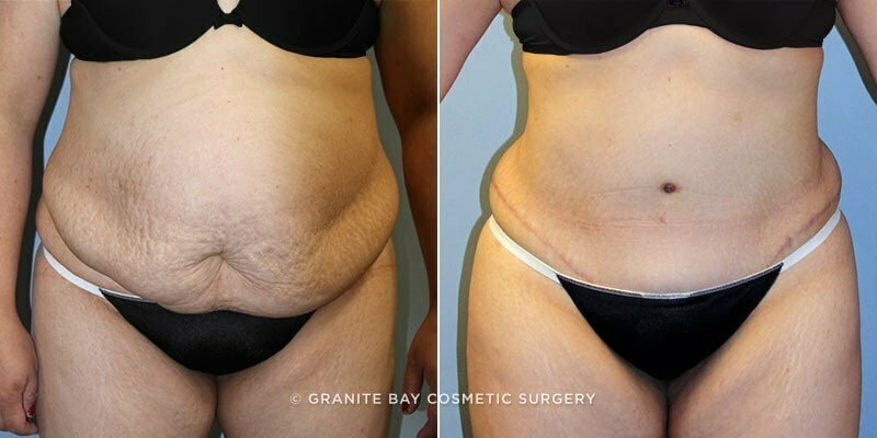 Case # 129 after photo